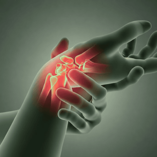 Knee joint illustration