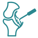 ACL PCL reconstruction icon