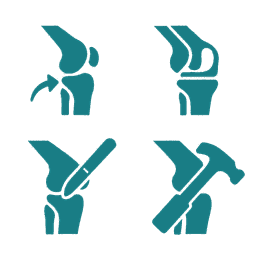 Joint Replacement Surgery