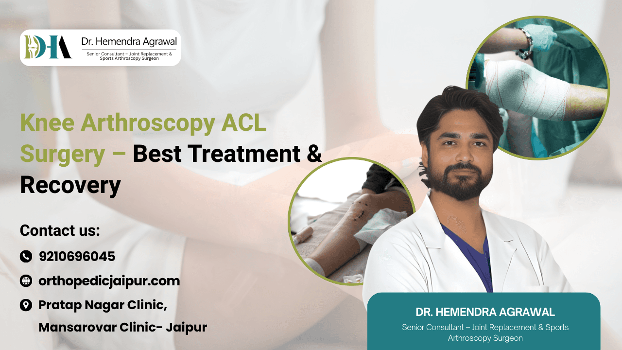 Knee Arthroscopy ACL Surgery – Best Treatment & Recovery
